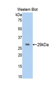 EZH2 Antibody - Western blot of recombinant EZH2.  This image was taken for the unconjugated form of this product. Other forms have not been tested.