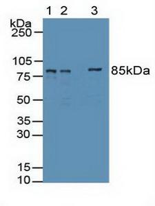 EZH2 Antibody - Western Blot; Sample: Lane1: Human 293T Cells; Lane2: Human HepG2 Cells Tissue; Lane3: Human Hela Cells Tissue.