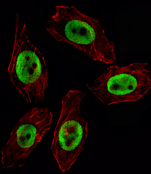 EZH2 Antibody - Fluorescent image of U251 cell stained with EZH2 Antibody. U251 cells were fixed with 4% PFA (20 min), permeabilized with Triton X-100 (0.1%, 10 min), then incubated with EZH2 primary antibody (1:25, 1 h at 37°C). For secondary antibody, Alexa Fluor 488 conjugated donkey anti-mouse antibody (green) was used (1:400, 50 min at 37°C). Cytoplasmic actin was counterstained with Alexa Fluor 555 (red) conjugated Phalloidin (7units/ml, 1 h at 37°C). EZH2 immunoreactivity is localized to Nucleus significantly.