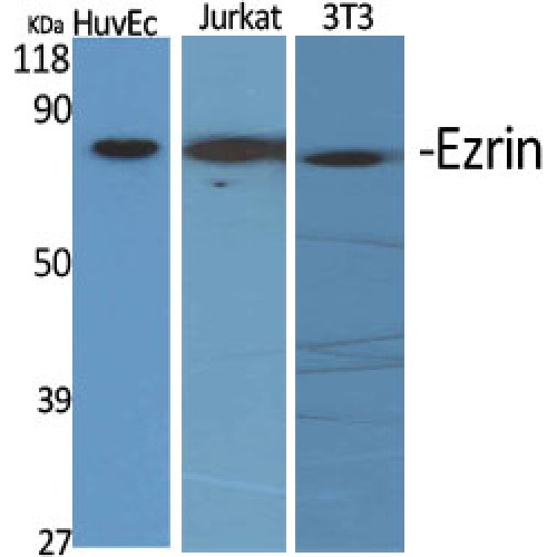 EZR / Ezrin Antibody - Western blot of Ezrin antibody