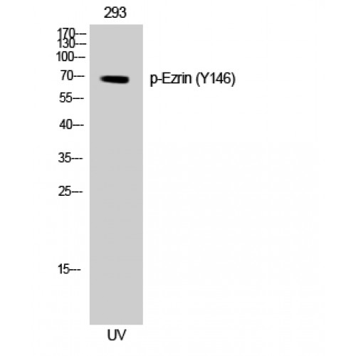 EZR / Ezrin Antibody - Western blot of Phospho-Ezrin (Y146) antibody