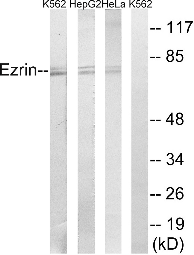 EZR / Ezrin Antibody - Western blot analysis of lysates from HeLa, HepG2, and K562 cells, using Ezrin Antibody. The lane on the right is blocked with the synthesized peptide.