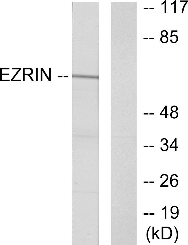 EZR / Ezrin Antibody - Western blot analysis of lysates from A431 cells, treated with EGF 200ng/ml 30', using Ezrin Antibody. The lane on the right is blocked with the synthesized peptide.