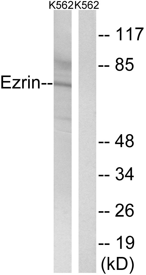 EZR / Ezrin Antibody - Western blot analysis of lysates from K562 cells, using Ezrin Antibody. The lane on the right is blocked with the synthesized peptide.