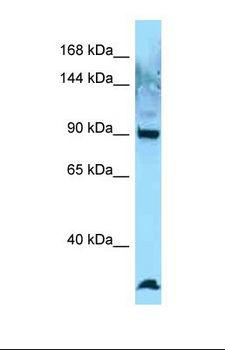 EZR / Ezrin Antibody - Western blot of Human Jurkat. EZR-ROS1 antibody dilution 1.0 ug/ml.  This image was taken for the unconjugated form of this product. Other forms have not been tested.