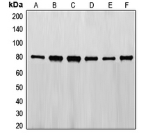 EZR / Ezrin Antibody - Western blot analysis of Ezrin expression in HeLa (A); NIH3T3 (B); C6 (C); COS7 (D); MCF7 (E); A431 (F) whole cell lysates.