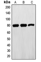 EZR / Ezrin Antibody - Western blot analysis of Ezrin expression in HeLa (A); A431 (B); SHSY5Y (C) whole cell lysates.