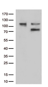 EZR / Ezrin Antibody - HEK293T cells were transfected with the pCMV6-ENTRY control. (Left lane) or pCMV6-ENTRY EZR. (Right lane) cDNA for 48 hrs and lysed. Equivalent amounts of cell lysates. (5 ug per lane) were separated by SDS-PAGE and immunoblotted with anti-EZR. (1:500)