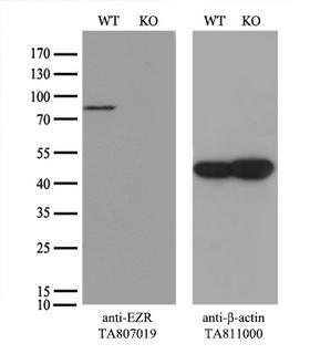 EZR / Ezrin Antibody - Equivalent amounts of cell lysates  and EZR-Knockout HeLa cells  were separated by SDS-PAGE and immunoblotted with anti-EZR monoclonal antibody. Then the blotted membrane was stripped and reprobed with anti-actin antibody as a loading control.