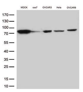 EZR / Ezrin Antibody - Western blot analysis of extracts. (35ug) from 5 cell lines lysates by using anti-EZR monoclonal antibody. (1:500)