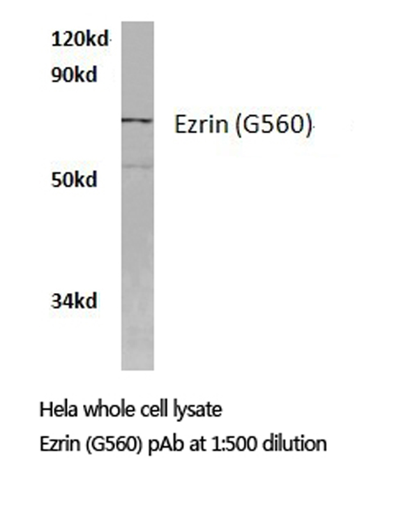 EZR / Ezrin Antibody - Western blot of Ezrin (G560) pAb in extracts from HeLa cells.