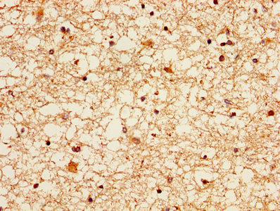 EZR / Ezrin Antibody - IHC image of EZR Antibody diluted at 1:300 and staining in paraffin-embedded human brain tissue performed on a Leica BondTM system. After dewaxing and hydration, antigen retrieval was mediated by high pressure in a citrate buffer (pH 6.0). Section was blocked with 10% normal goat serum 30min at RT. Then primary antibody (1% BSA) was incubated at 4°C overnight. The primary is detected by a biotinylated secondary antibody and visualized using an HRP conjugated SP system.