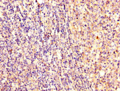 EZR / Ezrin Antibody - IHC image of EZR Antibody diluted at 1:300 and staining in paraffin-embedded human tonsil tissue performed on a Leica BondTM system. After dewaxing and hydration, antigen retrieval was mediated by high pressure in a citrate buffer (pH 6.0). Section was blocked with 10% normal goat serum 30min at RT. Then primary antibody (1% BSA) was incubated at 4°C overnight. The primary is detected by a biotinylated secondary antibody and visualized using an HRP conjugated SP system.