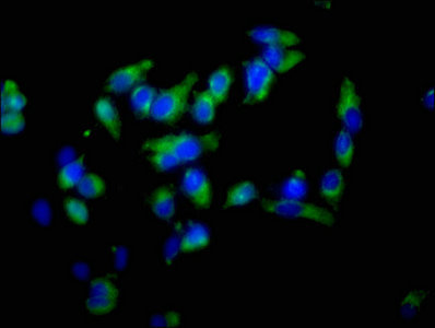 EZR / Ezrin Antibody - Immunofluorescence staining of Hela cells with EZR Antibody at 1:100, counter-stained with DAPI. The cells were fixed in 4% formaldehyde, permeabilized using 0.2% Triton X-100 and blocked in 10% normal Goat Serum. The cells were then incubated with the antibody overnight at 4°C. The secondary antibody was Alexa Fluor 488-congugated AffiniPure Goat Anti-Rabbit IgG(H+L).