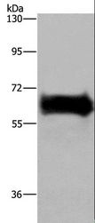 EZR / Ezrin Antibody - Western blot analysis of Mouse kidney tissue, using EZR Polyclonal Antibody at dilution of 1:300.