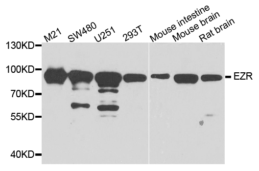 EZR / Ezrin Antibody - Western blot analysis of extracts of various cell lines, using EZR antibody at 1:1000 dilution. The secondary antibody used was an HRP Goat Anti-Rabbit IgG (H+L) at 1:10000 dilution. Lysates were loaded 25ug per lane and 3% nonfat dry milk in TBST was used for blocking. An ECL Kit was used for detection and the exposure time was 30s.