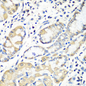 EZR / Ezrin Antibody - Immunohistochemistry of paraffin-embedded human stomach using EZR antibodyat dilution of 1:100 (40x lens).