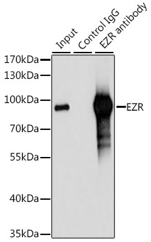 EZR / Ezrin Antibody - Immunoprecipitation analysis of 200ug extracts of 293T cells, using 3 ug EZR antibody. Western blot was performed from the immunoprecipitate using EZR antibodyat a dilition of 1:1000.