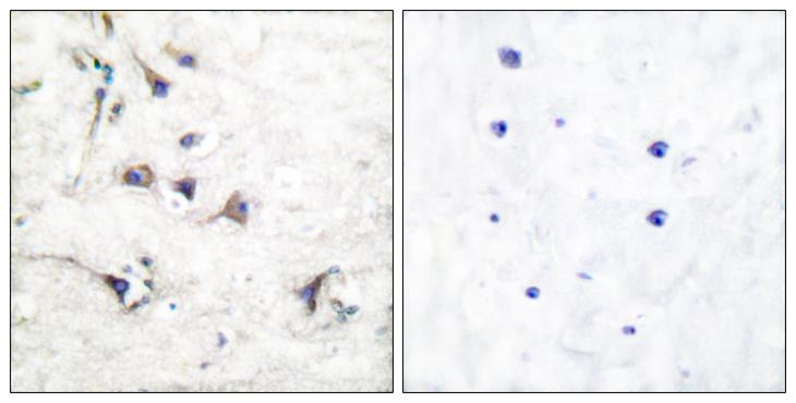 EZR / Ezrin Antibody - Peptide - + Immunohistochemical analysis of paraffin-embedded human brain tissue using Ezrin antibody.