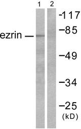 EZR / Ezrin Antibody - Western blot analysis of extracts from NIH/3T3 cells, using Ezrin antibody.