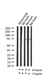 EZR / Ezrin Antibody - Western blot analysis of Phospho-Ezrin (Thr566) expression in various lysates