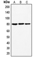 EZR / Ezrin Antibody - Western blot analysis of Ezrin (pT567) expression in HeLa (A); A431 (B); SHSY5Y (C) whole cell lysates.
