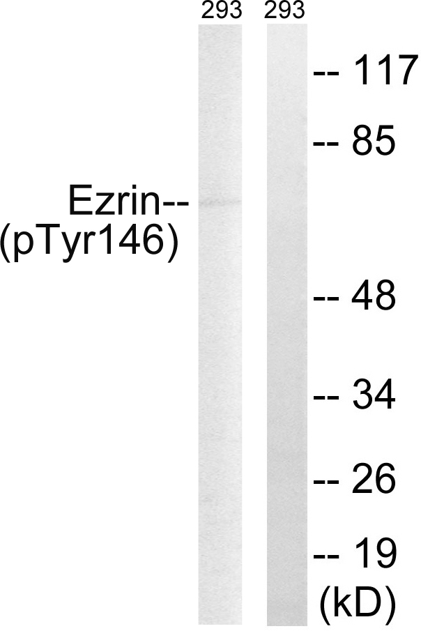 EZR / Ezrin Antibody - Western blot analysis of lysates from 293 cells treated with UV 15', using Ezrin (Phospho-Tyr146) Antibody. The lane on the right is blocked with the phospho peptide.