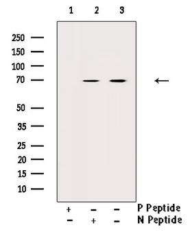 EZR / Ezrin Antibody - Western blot analysis of Phospho-Ezrin (Tyr146) antibody expression in UV treated 293 cells lysates. The lane on the right is treated with the antigen-specific peptide.