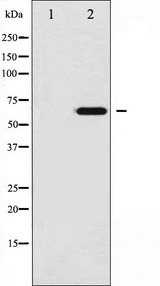 EZR / Ezrin Antibody - Western blot analysis of Ezrin phosphorylation expression in UV treated 293 whole cells lysates. The lane on the left is treated with the antigen-specific peptide.