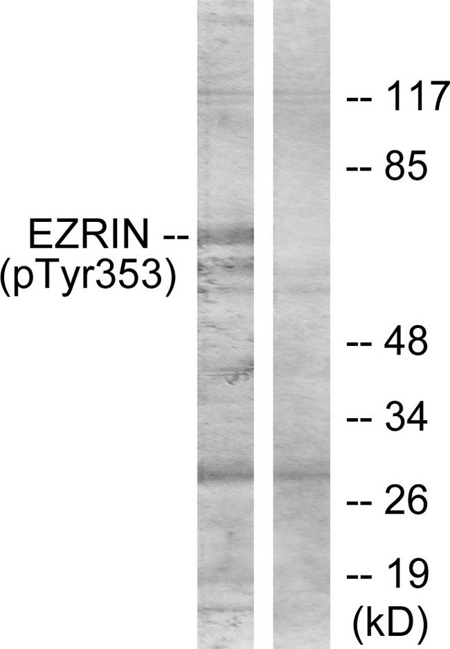EZR / Ezrin Antibody - Western blot analysis of lysates from A431 cells treated with EGF 200ng/ml 30', using Ezrin (Phospho-Tyr353) Antibody. The lane on the right is blocked with the phospho peptide.