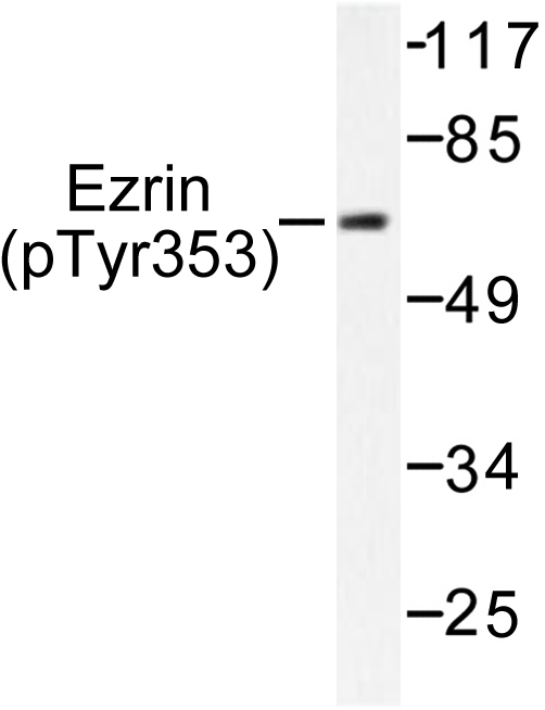 EZR / Ezrin Antibody - Western blot of p-Ezrin (Y353) pAb in extracts from HT-29 cells treated with Calyculin A 50ng/ml.