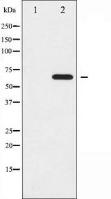 EZR / Ezrin Antibody - Western blot analysis of Ezrin phosphorylation expression in EGF treated A431 whole cells lysates. The lane on the left is treated with the antigen-specific peptide.