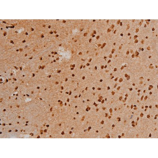 EZR / Ezrin Antibody - 1:200 staining mouse brain tissue by IHC-P. The tissue was formaldehyde fixed and a heat mediated antigen retrieval step in citrate buffer was performed. The tissue was then blocked and incubated with the antibody for 1.5 hours at 22°C. An HRP conjugated goat anti-rabbit antibody was used as the secondary.