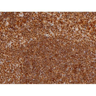 EZR / Ezrin Antibody - 1:200 staining mouse spleen tissue by IHC-P. The tissue was formaldehyde fixed and a heat mediated antigen retrieval step in citrate buffer was performed. The tissue was then blocked and incubated with the antibody for 1.5 hours at 22°C. An HRP conjugated goat anti-rabbit antibody was used as the secondary.