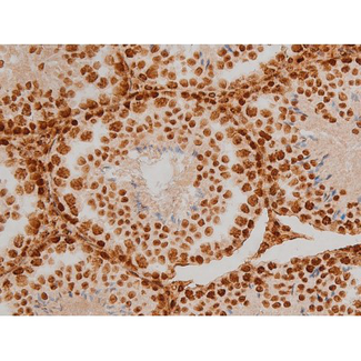 EZR / Ezrin Antibody - 1:200 staining mouse testis tissue by IHC-P. The tissue was formaldehyde fixed and a heat mediated antigen retrieval step in citrate buffer was performed. The tissue was then blocked and incubated with the antibody for 1.5 hours at 22°C. An HRP conjugated goat anti-rabbit antibody was used as the secondary.