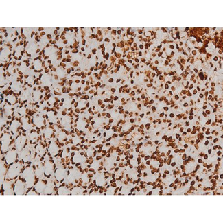EZR / Ezrin Antibody - 1:200 staining rat ganstric tissue by IHC-P. The tissue was formaldehyde fixed and a heat mediated antigen retrieval step in citrate buffer was performed. The tissue was then blocked and incubated with the antibody for 1.5 hours at 22°C. An HRP conjugated goat anti-rabbit antibody was used as the secondary.