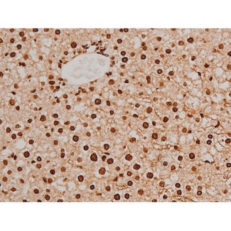 EZR / Ezrin Antibody - 1:200 staining rat liver tissue by IHC-P. The tissue was formaldehyde fixed and a heat mediated antigen retrieval step in citrate buffer was performed. The tissue was then blocked and incubated with the antibody for 1.5 hours at 22°C. An HRP conjugated goat anti-rabbit antibody was used as the secondary.
