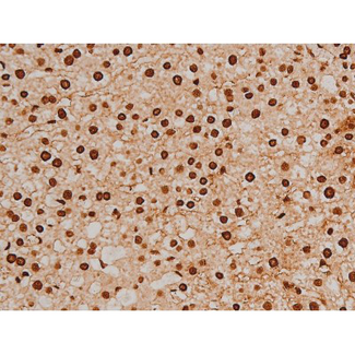 EZR / Ezrin Antibody - 1:200 staining rat liver tissue by IHC-P. The tissue was formaldehyde fixed and a heat mediated antigen retrieval step in citrate buffer was performed. The tissue was then blocked and incubated with the antibody for 1.5 hours at 22°C. An HRP conjugated goat anti-rabbit antibody was used as the secondary.