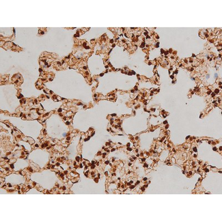 EZR / Ezrin Antibody - 1:200 staining rat lung tissue by IHC-P. The tissue was formaldehyde fixed and a heat mediated antigen retrieval step in citrate buffer was performed. The tissue was then blocked and incubated with the antibody for 1.5 hours at 22°C. An HRP conjugated goat anti-rabbit antibody was used as the secondary.
