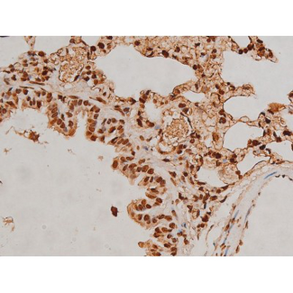 EZR / Ezrin Antibody - 1:200 staining rat lung tissue by IHC-P. The tissue was formaldehyde fixed and a heat mediated antigen retrieval step in citrate buffer was performed. The tissue was then blocked and incubated with the antibody for 1.5 hours at 22°C. An HRP conjugated goat anti-rabbit antibody was used as the secondary.