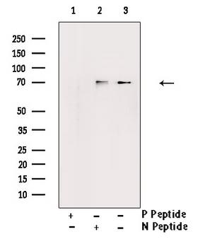 EZR / Ezrin Antibody - Western blot analysis of Phospho-Ezrin (Tyr478) antibody expression in Na3VO4 treated K562 cells lysates. The lane on the right is treated with the antigen-specific peptide.