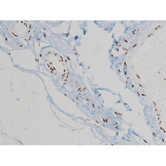 EZR / Ezrin Antibody - 1:200 staining human heart tissue by IHC-P. The tissue was formaldehyde fixed and a heat mediated antigen retrieval step in citrate buffer was performed. The tissue was then blocked and incubated with the antibody for 1.5 hours at 22°C. An HRP conjugated goat anti-rabbit antibody was used as the secondary.