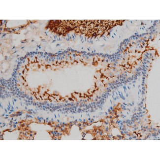 EZR / Ezrin Antibody - 1:200 staining mouse lung tissue by IHC-P. The tissue was formaldehyde fixed and a heat mediated antigen retrieval step in citrate buffer was performed. The tissue was then blocked and incubated with the antibody for 1.5 hours at 22°C. An HRP conjugated goat anti-rabbit antibody was used as the secondary.