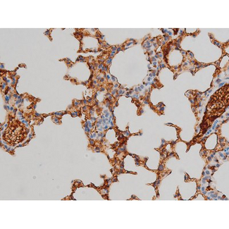 EZR / Ezrin Antibody - 1:200 staining mouse lung tissue by IHC-P. The tissue was formaldehyde fixed and a heat mediated antigen retrieval step in citrate buffer was performed. The tissue was then blocked and incubated with the antibody for 1.5 hours at 22°C. An HRP conjugated goat anti-rabbit antibody was used as the secondary.