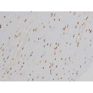 EZR / Ezrin Antibody - 1:200 staining rat heart tissue by IHC-P. The tissue was formaldehyde fixed and a heat mediated antigen retrieval step in citrate buffer was performed. The tissue was then blocked and incubated with the antibody for 1.5 hours at 22°C. An HRP conjugated goat anti-rabbit antibody was used as the secondary.