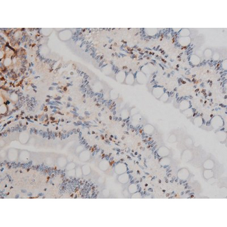 EZR / Ezrin Antibody - 1:200 staining rat intestinal tissue by IHC-P. The tissue was formaldehyde fixed and a heat mediated antigen retrieval step in citrate buffer was performed. The tissue was then blocked and incubated with the antibody for 1.5 hours at 22°C. An HRP conjugated goat anti-rabbit antibody was used as the secondary.
