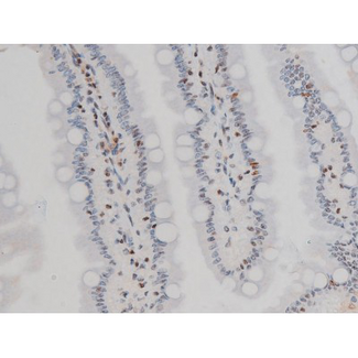 EZR / Ezrin Antibody - 1:200 staining rat intestinal tissue by IHC-P. The tissue was formaldehyde fixed and a heat mediated antigen retrieval step in citrate buffer was performed. The tissue was then blocked and incubated with the antibody for 1.5 hours at 22°C. An HRP conjugated goat anti-rabbit antibody was used as the secondary.