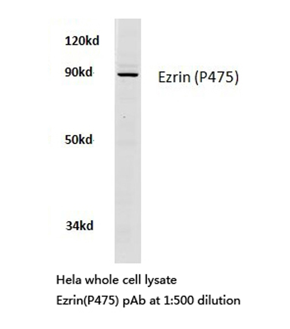 EZR / Ezrin Antibody - Western blot of Ezrin (P475) pAb in extracts from HeLa cells.