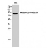 Ezrin + Radixin + Moesin Antibody - Western blot of Moesin/Ezrin/Radixin antibody