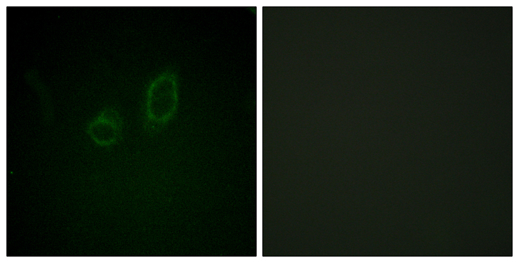 Ezrin + Radixin + Moesin Antibody - Immunofluorescence analysis of A549 cells, using Moesin/Ezrin/Radixin (Phospho-Thr558) Antibody. The picture on the right is blocked with the phospho peptide.